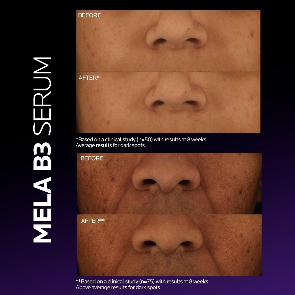 La Roche-Posay Mela B3 Serum