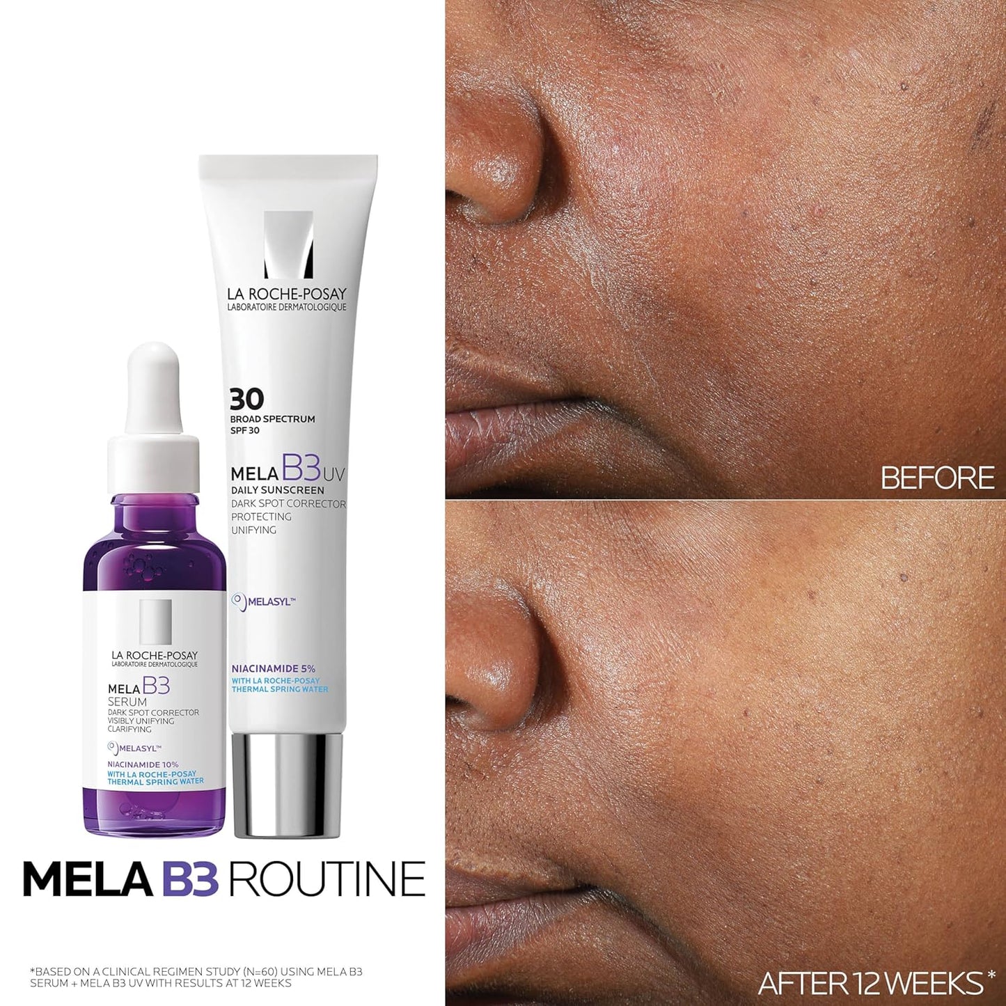 La Roche-Posay Mela B3 Serum