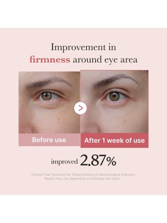 Medicube PDRN Pink Peptide Eye Cream 30ml- Κρέμα ματιών με ρετινόλη και pdrn