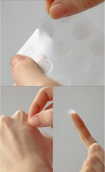 Some By Mi 30 Days Miracle Clear Spot Patch – Επιθέματα για Ακμή
