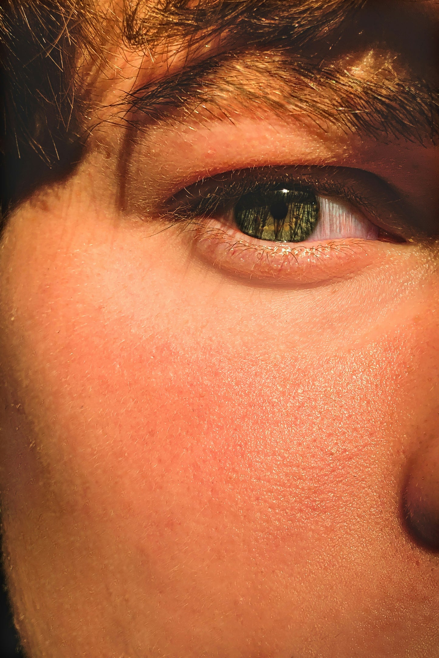 La Roche-Posay Anthelios Post-Uv Exposure After Sun Lotion Ενυδατική Λοσιόν για Μετά τον Ήλιο – 200ml
