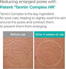 Dr. Melaxin BP Pore Clear Facial Mask - Μάσκα με Μικροβελόνες & Νιασιναμίδη για βαθύ καθαρισμό