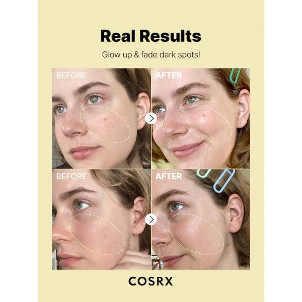 COSRX The Vitamin C 23 Serum – 20ml