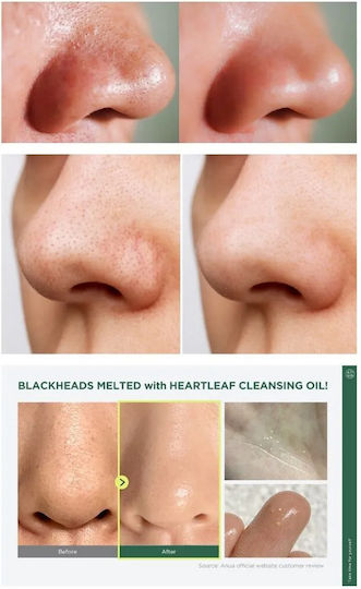 Anua Heartleaf Pore Control Cleansing Oil
