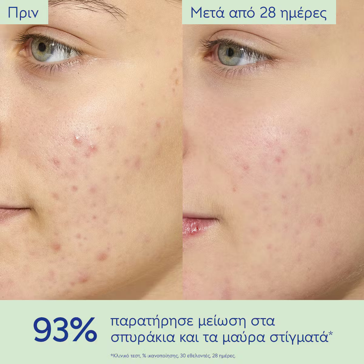 Caudalie Vinopure Moisturizing Mattifying Fluid Ενυδατική Κρέμα για Επιδερμίδες με Τάση Ακμής, 60ml