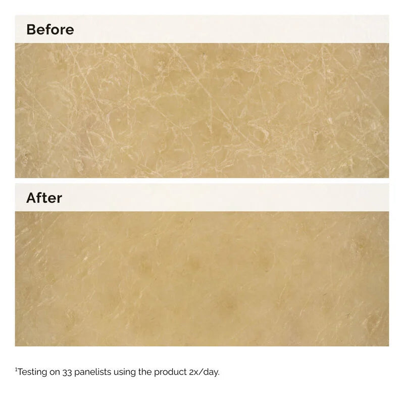 The Ordinary Body Care Natural Moisturizing Factors & Inulin Body Lotion Ενυδατική Λοσιόν Σώματος, 240ml