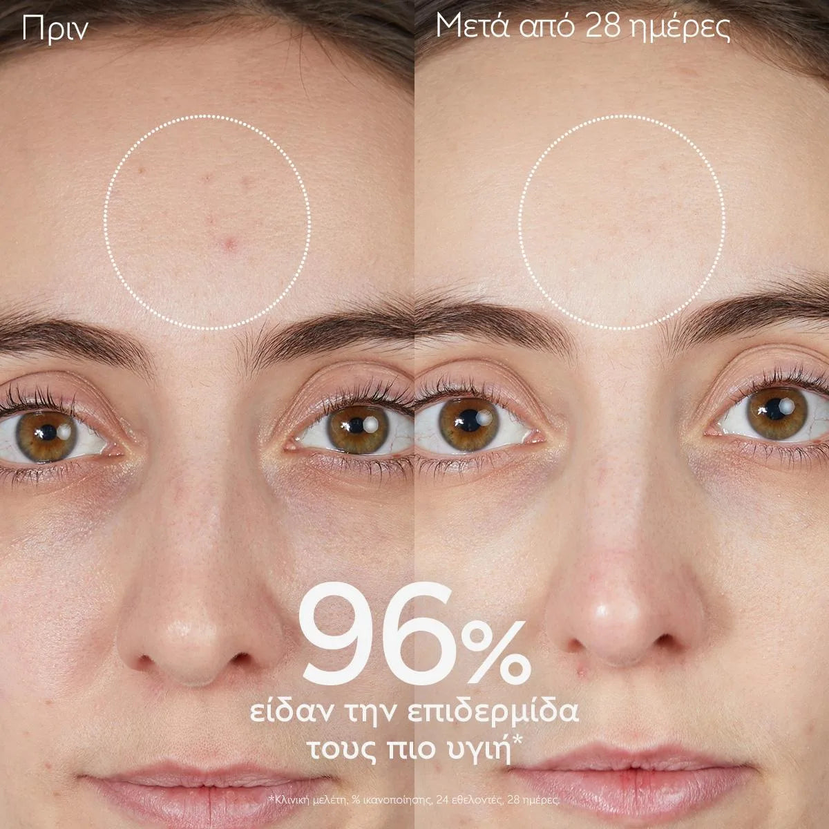 Caudalie Vinopure Purifying Gel Cleanser Καθαριστικό Προσώπου κατά των Ατελειών, 75ml