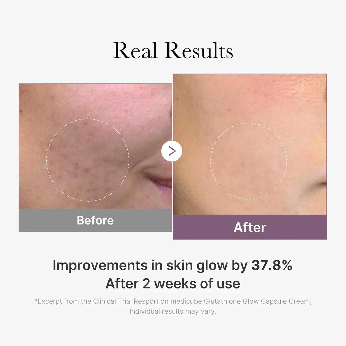 Medicube Glutathione Glow Capsule Cream- Κρέμα λάμψης με κάψουλες γλουταθειόνης