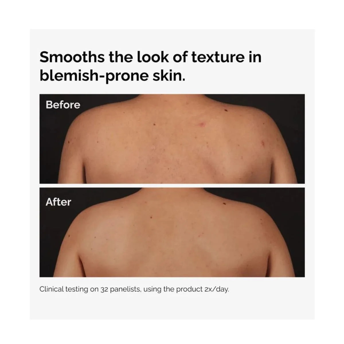 The Ordinary Salicylic Acid 0.5% Body Serum 240 ml