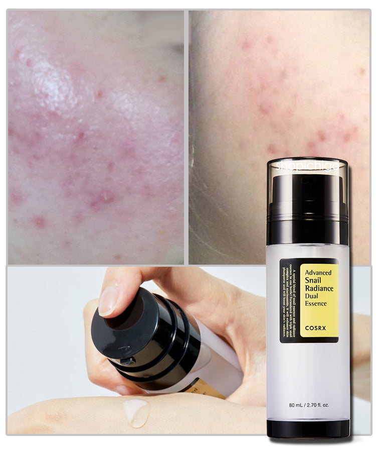 COSRX Advanced Snail Radiance Dual Essence