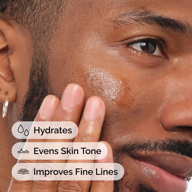 The Ordinary Retinol 1% in Squalane Ορός Αντιγήρανσης, 30ml
