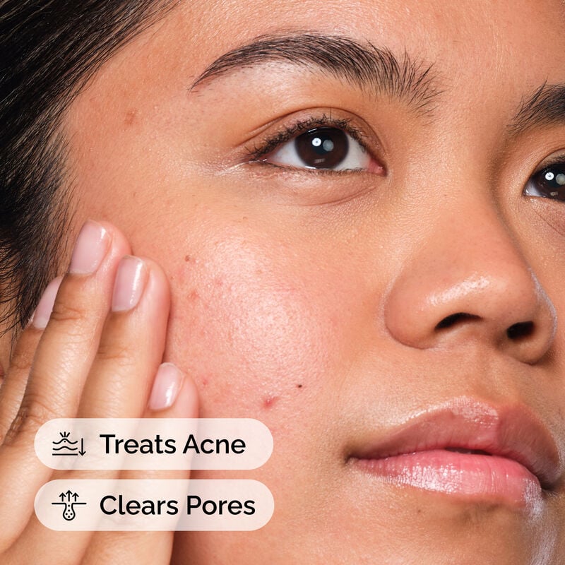 The Ordinary Salicylic Acid 2% Solution 30ml