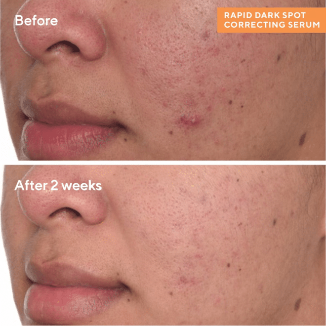 Axis-Y Dark Spot Correcting Glow Serum – Ορός Προσώπου για Κηλίδες Λάμψη, 50ml