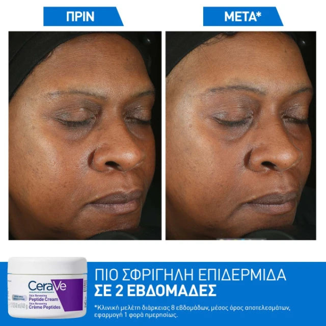 Cerave Skin Renewing Peptide Κρέμα Προσώπου 48 gr