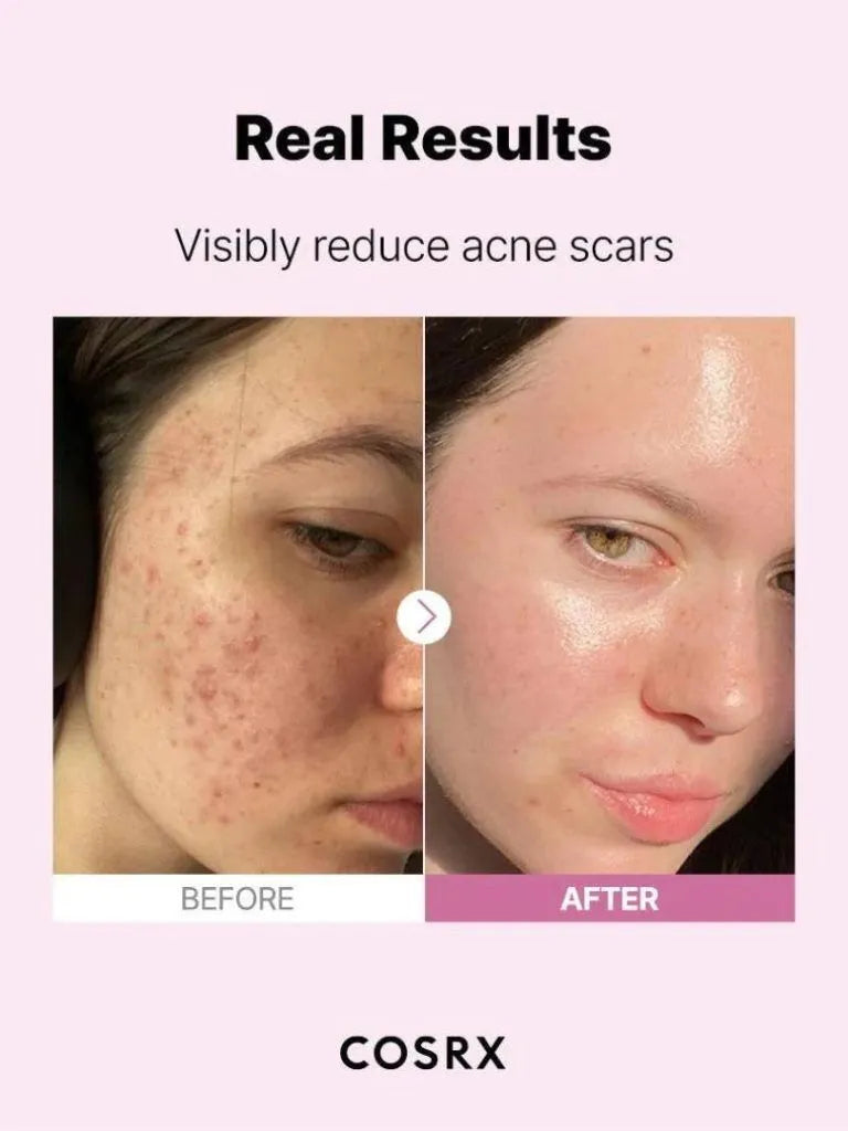 COSRX The Niacinamide 15 Serum – Σαπούνι Προσώπου με 15% Νιασιναμίδη (20ml)