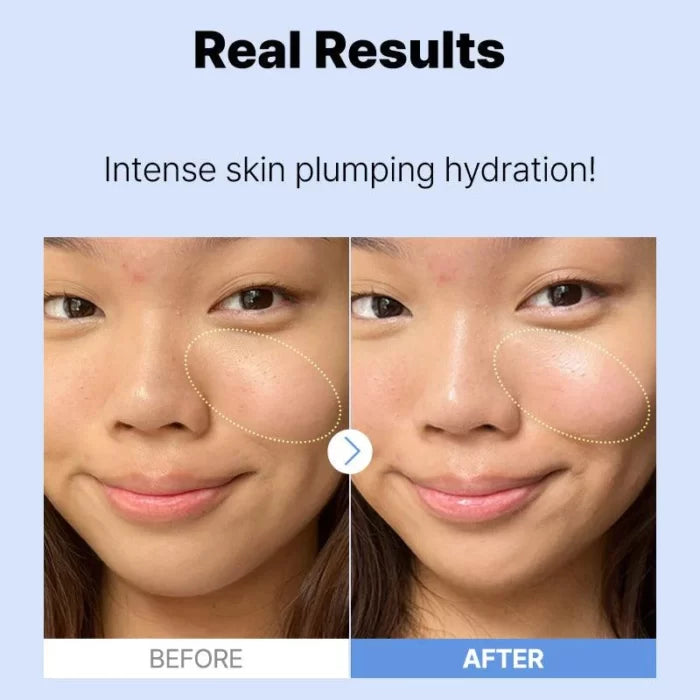 COSRX The Hyaluronic Acid 3 Serum – 20ml