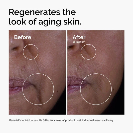 The Ordinary GF Solution 15% Αντιγηραντικός Ορός Προσώπου, 30ml