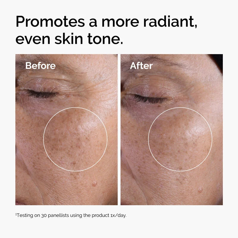 The Ordinary Glycolic Acid 7% Exfoliating Toner για Ήπια Απολέπιση σε Πρόσωπο & Τριχωτό, 240ml