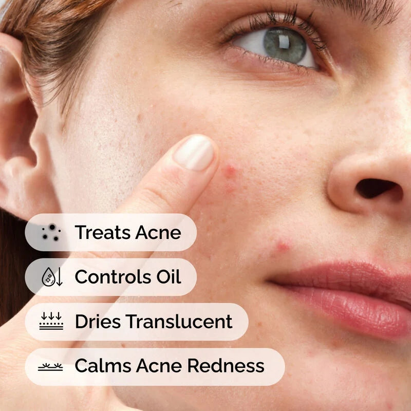 The Ordinary Sulfur 10% Powder to Cream Κρέμα Προσώπου κατά των Ατελειών & της Ακμής 5gr